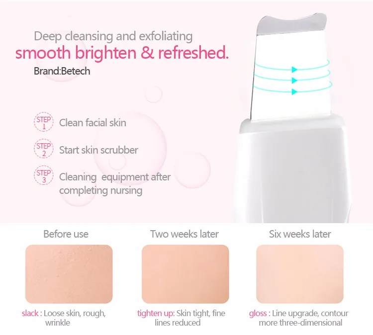 ultrathin portable ultrasonic skin scrubber Peeling Machine