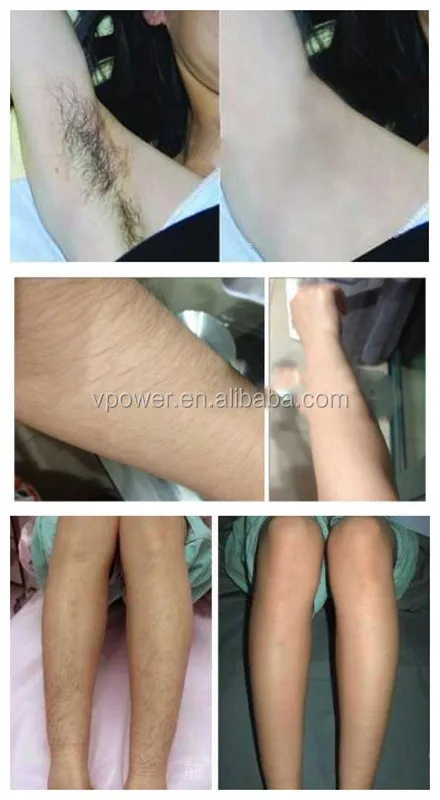 2016 Ipl hair removal and skin rejuvenation home used beauty machine