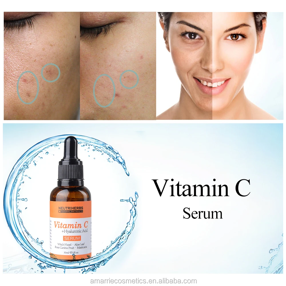 collagene et acide hyaluronique femme collagene et acide hyaluronique femme