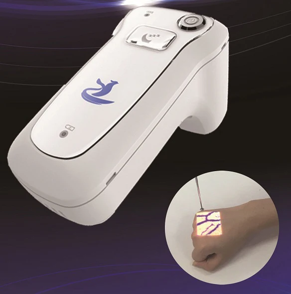 portable vein viewer price