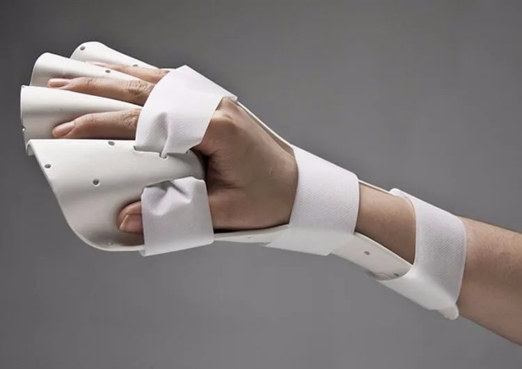 Ideal Splinting Material For Prosthetics And Orthopedics Companies