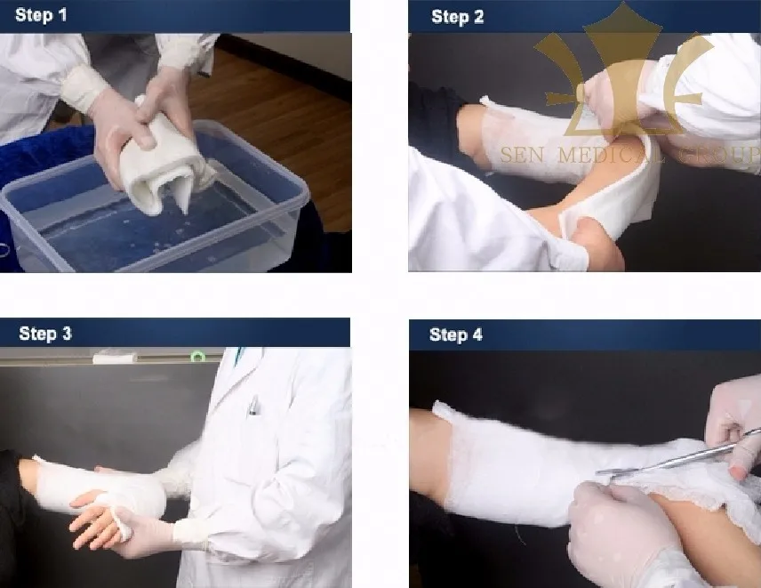 Medical Splint Roll Synthetic Fiberglass Casting Splint Roll Buy Medical Splint Roll Synthetic