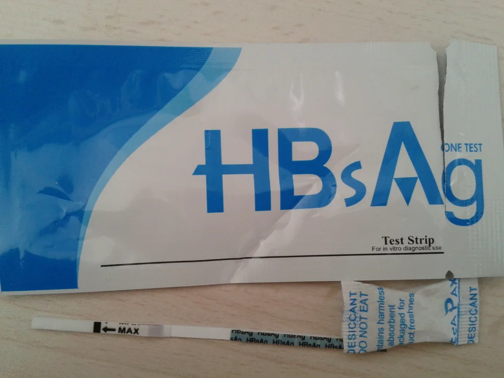 Hbsag Test Strip Hepatitis B Virus Surface Antigen Rapid Test Strip ...