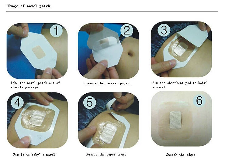 Transparent and waterproof adhesive iv catheter fixation dressings