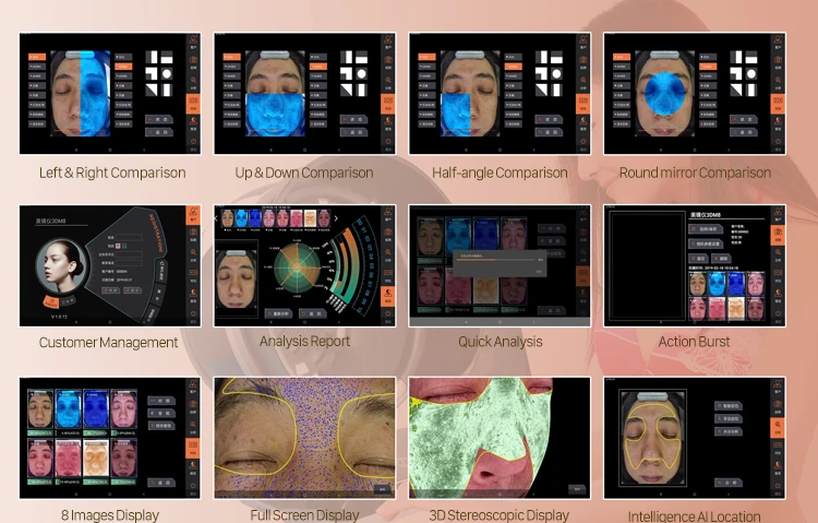 skin analyzer.3.jpg