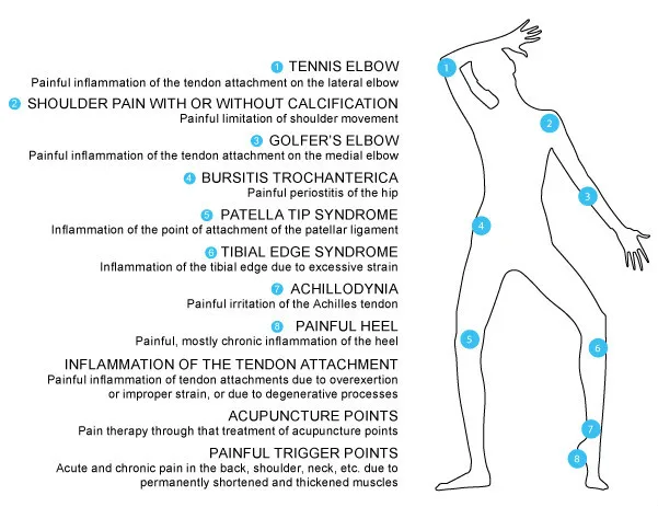 shockwave therapy machine