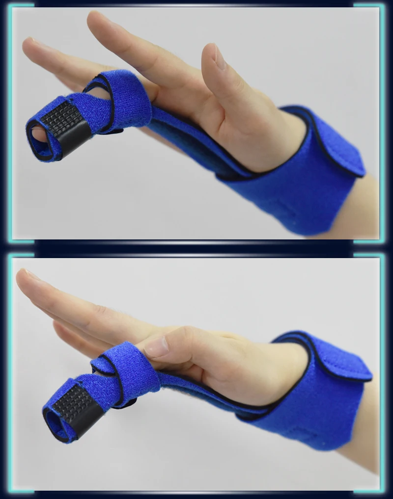 Finger-splint-GS394_05