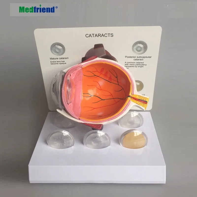 Factory Price Advanced Anatomical Eye Model Buy Advanced Anatomical