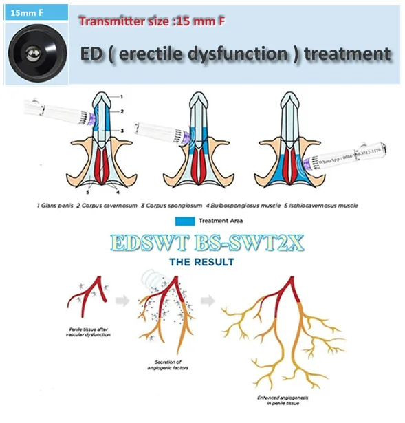 ビーガン食と勃起不全
