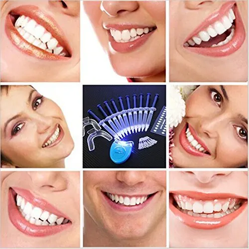 Teeth whitening at home cheap