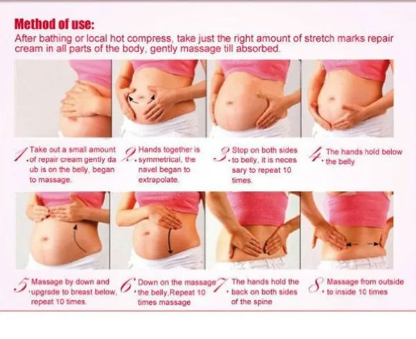 intensive stretch marks cream