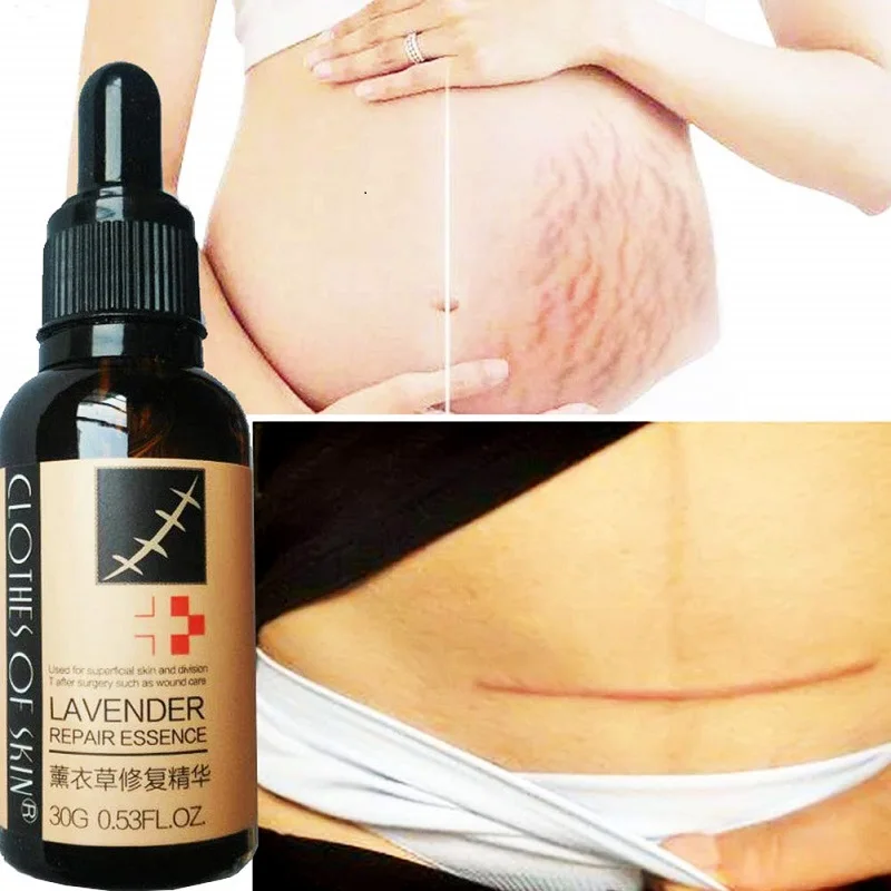 scar repair liquid (3).jpg