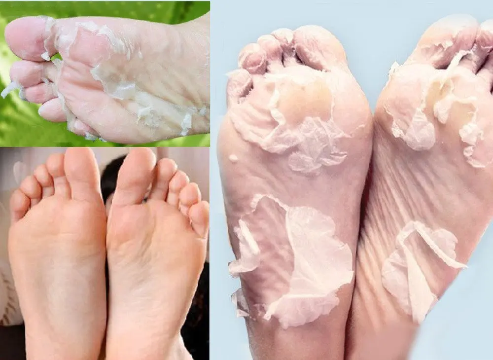 Scala 3 Packs=6pcs Exfoliating Foot Mask Socks Milk Bamboo Vinegar Peeling Mask Foot Care Mask Foot Spa Tender Skin Baby Feet Care Pedicure Socks (3 Packs)