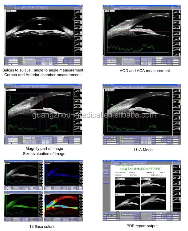 portable ophthalmic a b scan,optical ubm connect to computer