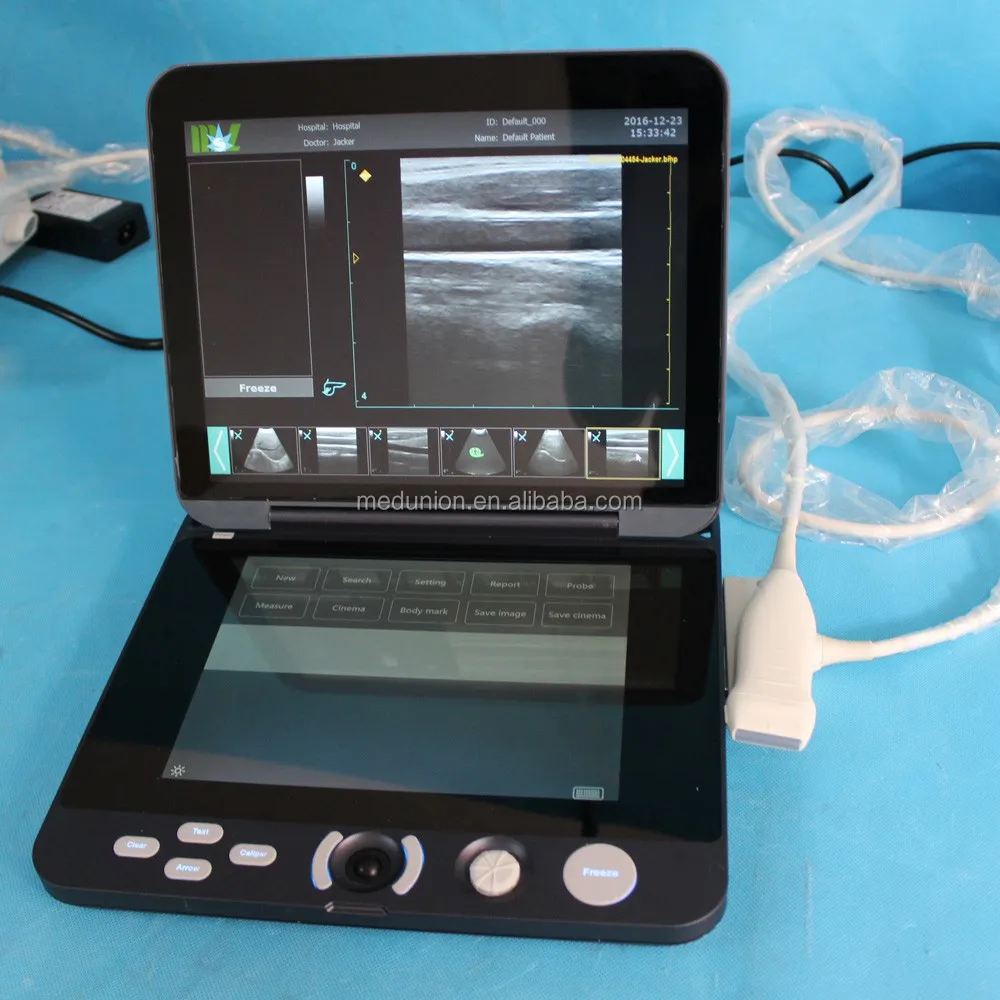 Cheapest Full Digital Black And White Portable Ultrasound Machine Price