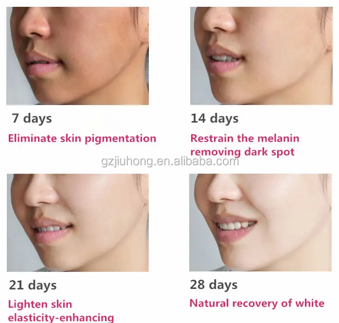best bleaching cream for dark spots