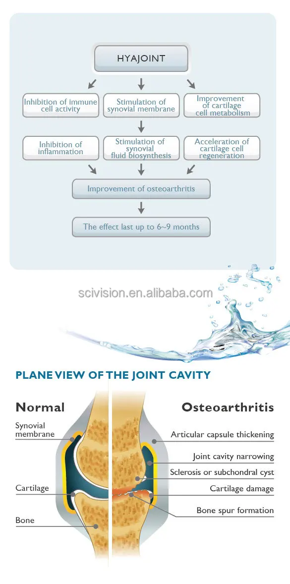 injections sunovial fluid in knee