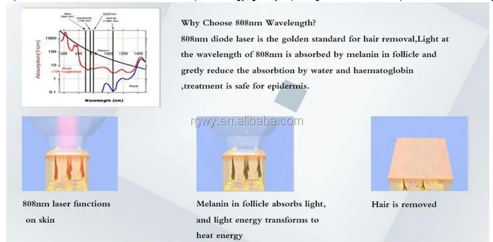 808nm diode laser hair removal