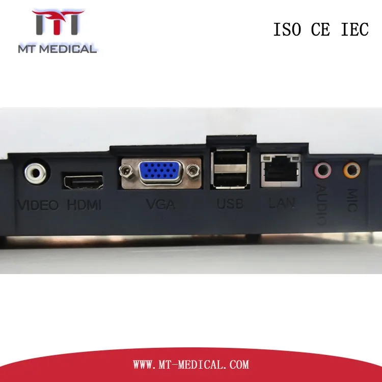 Portable doppler Ultrasound Machine Laptop color ultrasound Machine