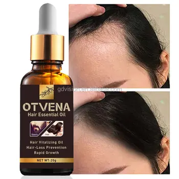Hair Growth Essence Anti Hair Loss Product Otvena Hair Essential