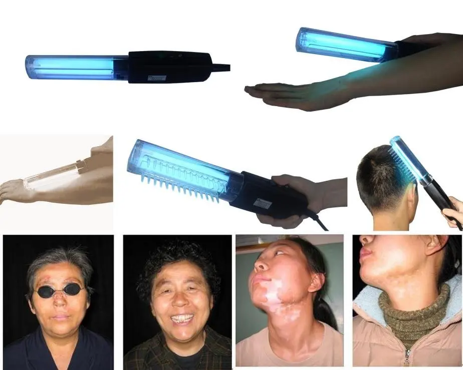 Derma Light Therapy For Psoriasis,Vitiligo,Eczema,Atopic Dermatitis