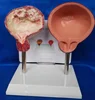 A comparative model of smoking bladder and normal bladder medical bladder model
