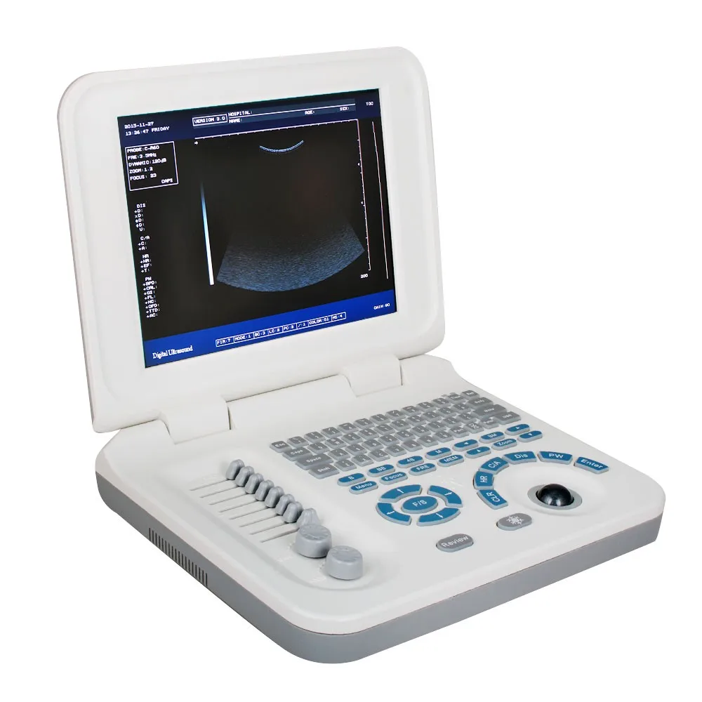 Carejoy Laptop Ultrasound Scanner With Multi Frequency Probe Ultrasonic