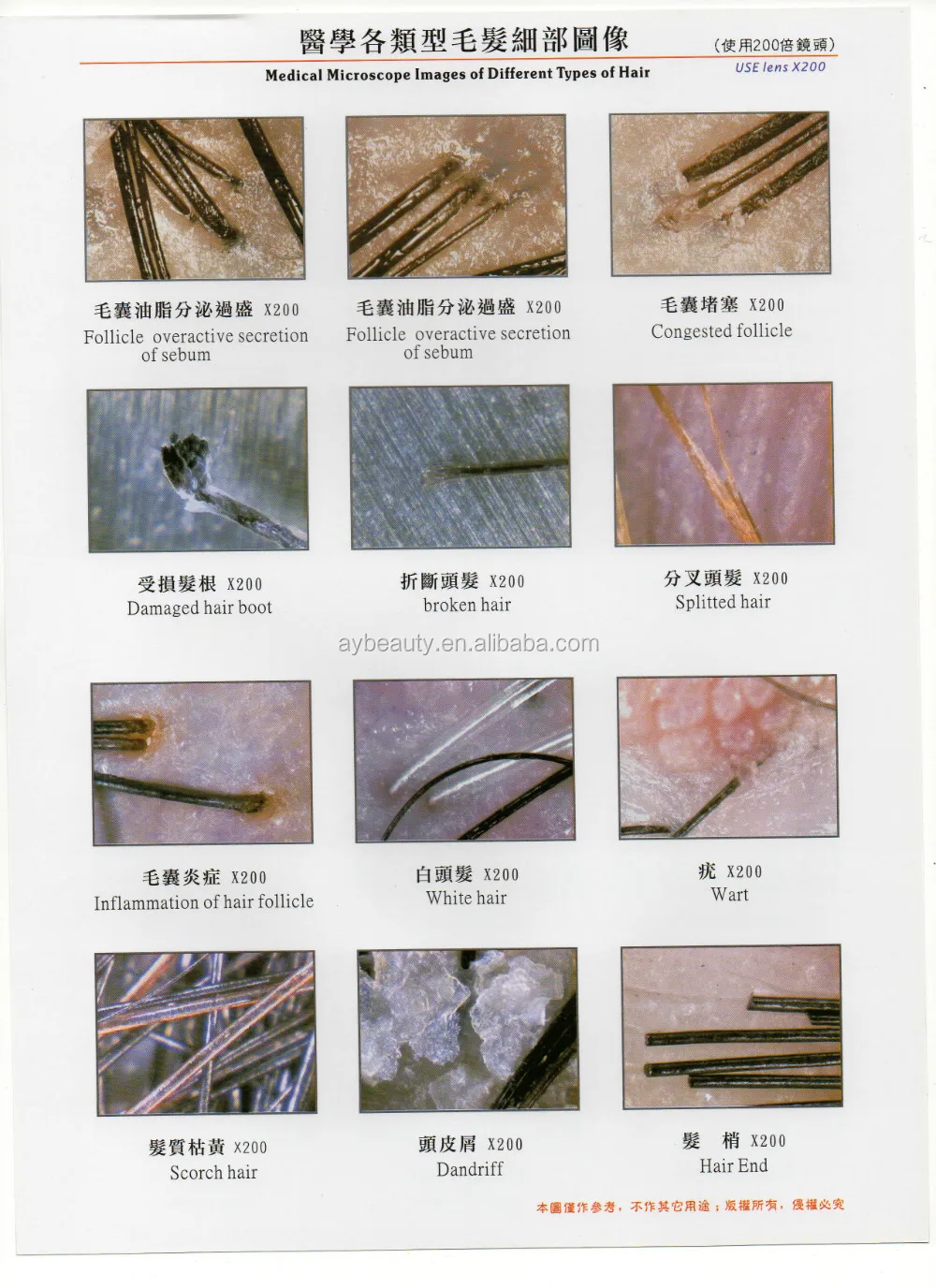 Ayjj015 Hair Beauty Salon Specified Hair And Scalp Analysis System