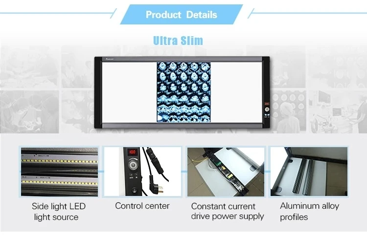 3 bay x ray display board flat led light.jpg_.webp.jpg