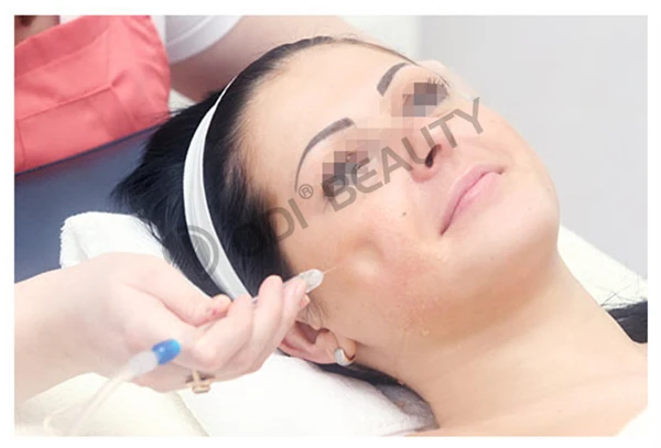 Hot! 250mw intensity skin rejuvenation water oxygen jet peel machine