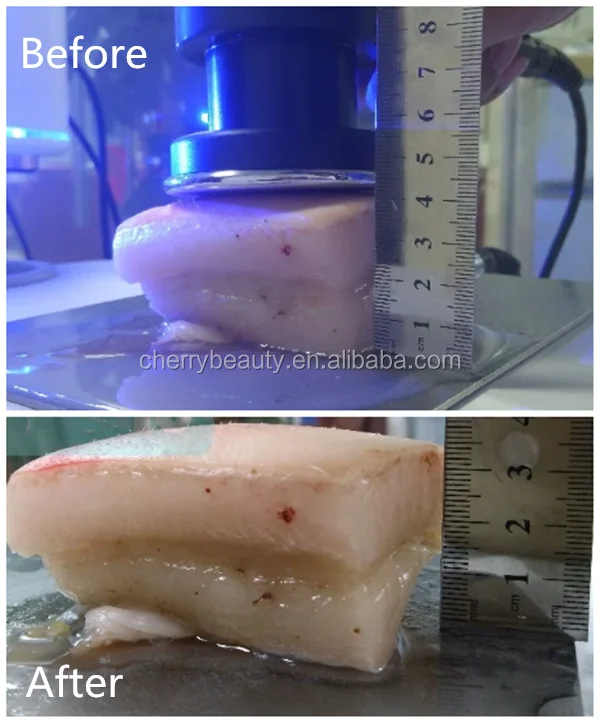 skin deep electrolysis skin deep electrolysis