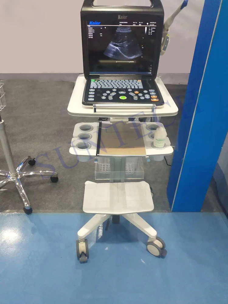 actual ultrasound.jpg