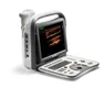 Medical pregnancy ultrasound gender sonoscape A6 with high quality images