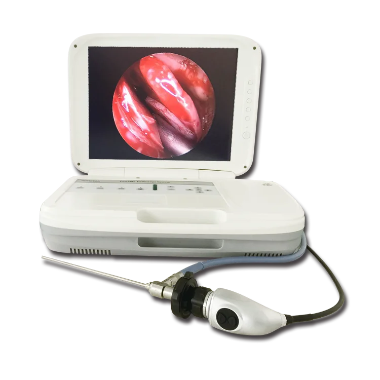 Hd Portable Ent Endoscope Buy Endoscope,Hd Endoscope,Portable