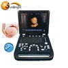 mobile medical ultrasound 3d ultrasound pregnancy machine /notebook ultrasound scanner price