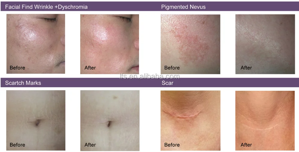 7X40LLE]2DO~B`EG%LGFKR