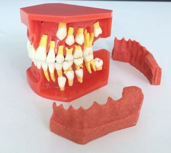 children deciduous teeth replacement process model