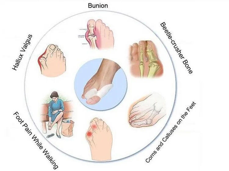 toe strecher_.jpg