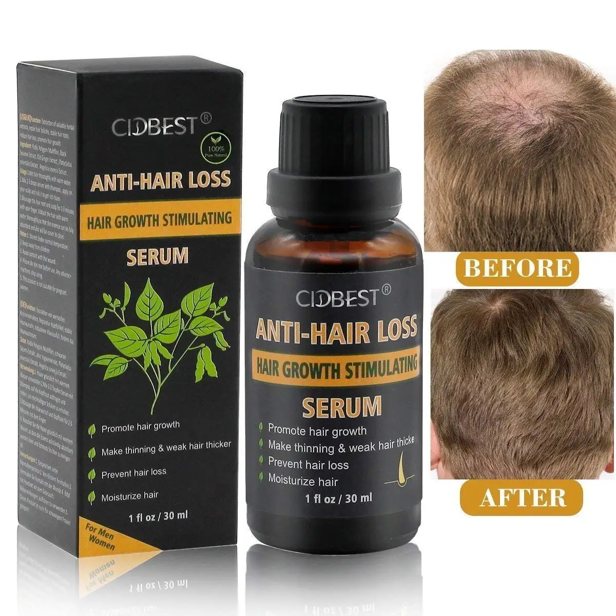 Cheap Sattvik Hair Loss Serum Review, find Sattvik Hair Loss Serum