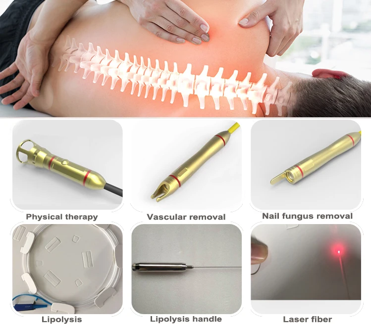 980nm laser physiotherapy
