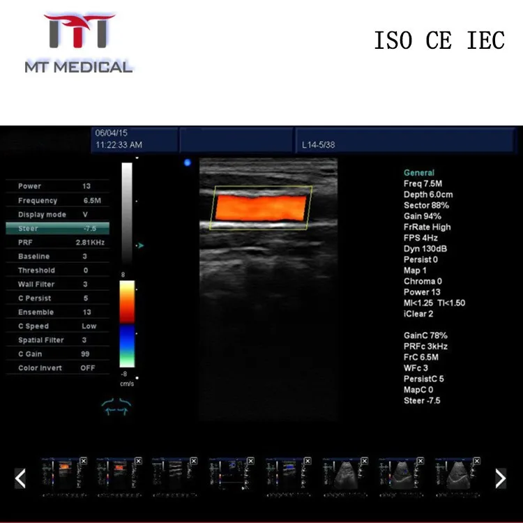 Full digital 4D portable Color Doppler ultrasound machine on sale with factory price