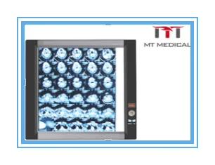Portable Medical Led X Ray Negatoscope Triple Machine