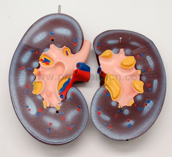PH03-010 Medical Anatomy Human Kidney Model (07)