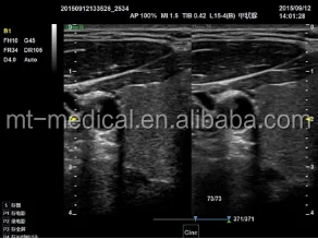 Portable Ultrasonic Diagnostic Devices Type Ultrasound Machine For Pregnancy
