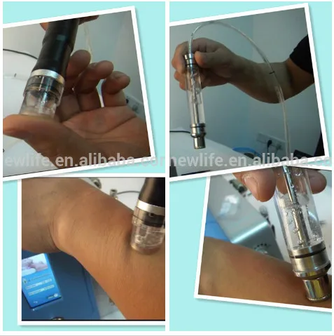 dermabrasion