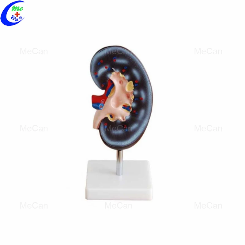 Kidney Model (1 Part)
