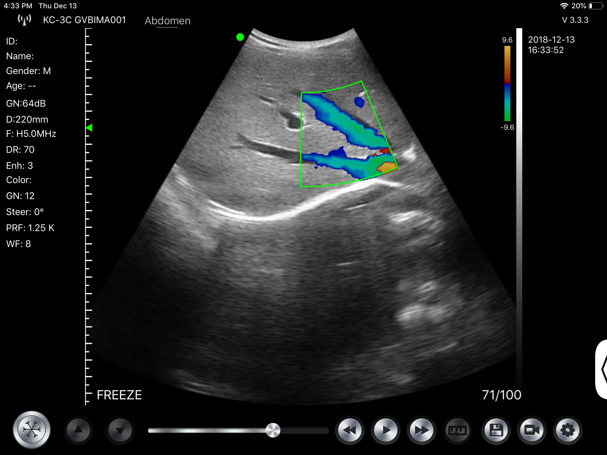 Eco doppler abdominal para que sirve