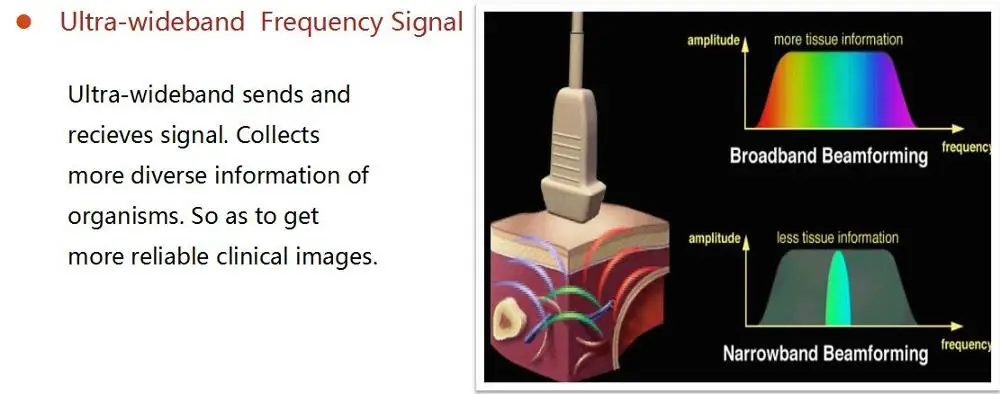 MT Medical Veterinary Ultrasound Machine