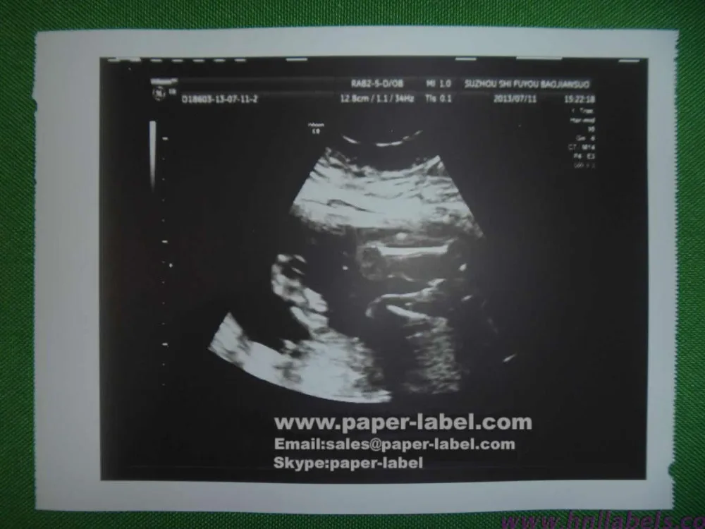 Ultrasound Paper Film/ UPP-110HD UPP-110S UPP-110HG KP61B-CE KP91HG substitute/Medical