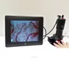 DMX980-1 Biological Microcirculation Microscope digital microscope capillary microscope